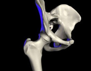 Was kostet die neue Hüfte? Foto Wikipedia